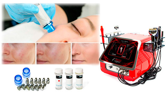 hydrodermabrasion machines
