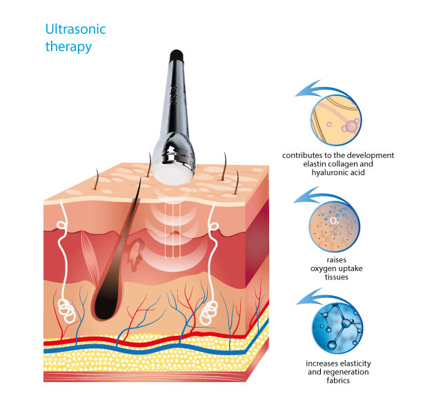 ultrasound therapy machines alvi prague