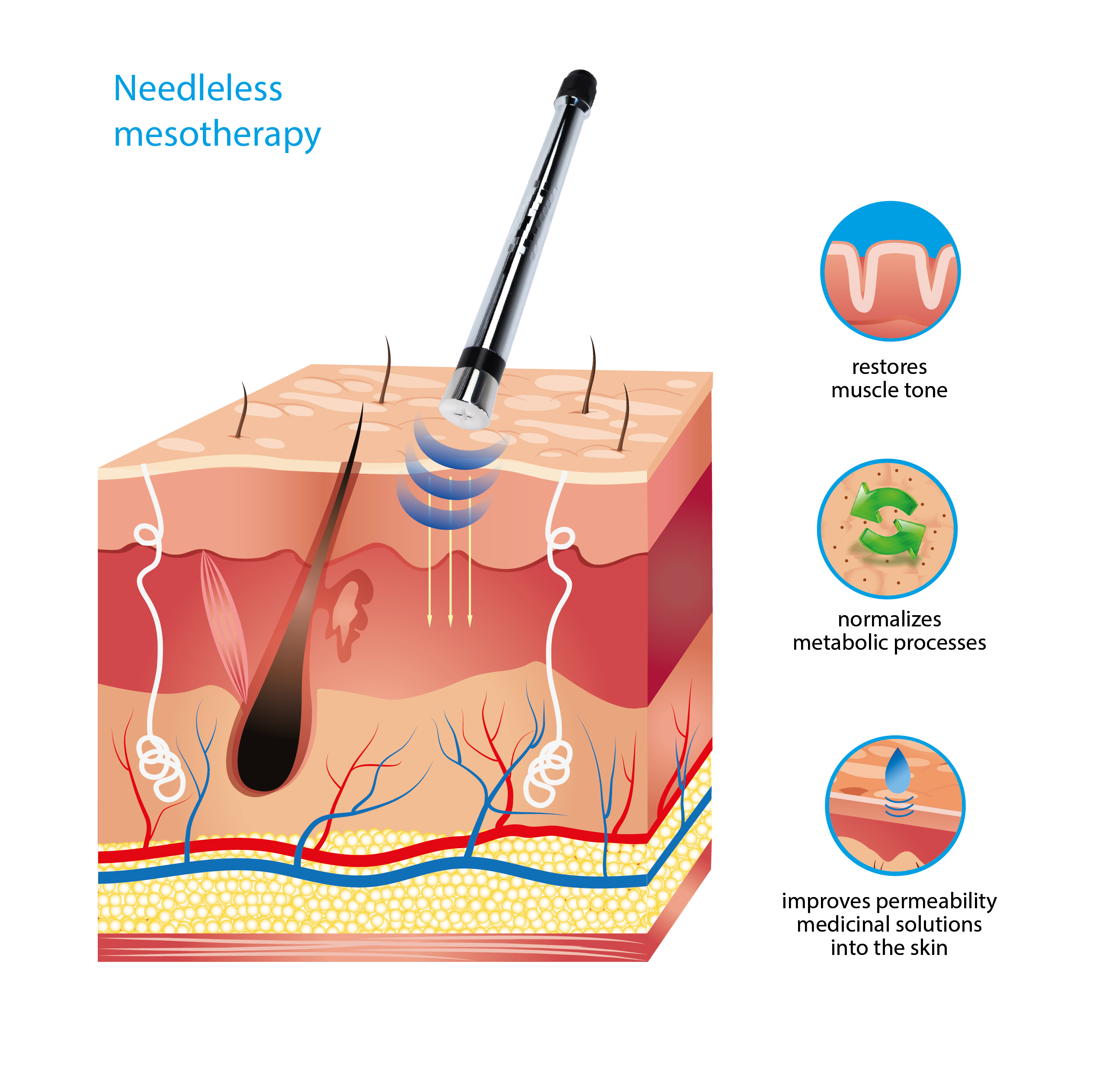 Needle-free mesotherapy s-03