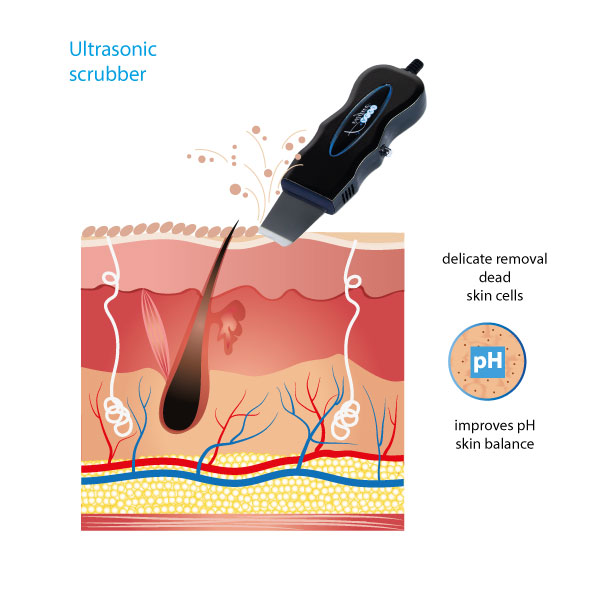 Ultrasonic scrubber in the S-02